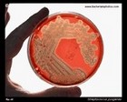 GAS on Petri dish